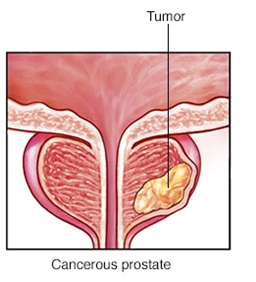 Dr. Mayank Mohan Agarwal - Urologist in Lucknow
